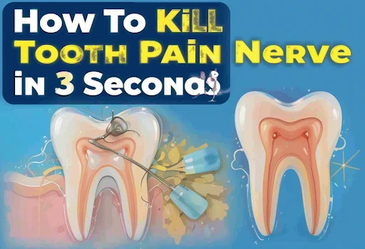 How to Kill Tooth Pain Nerve in 3 Seconds Permanently